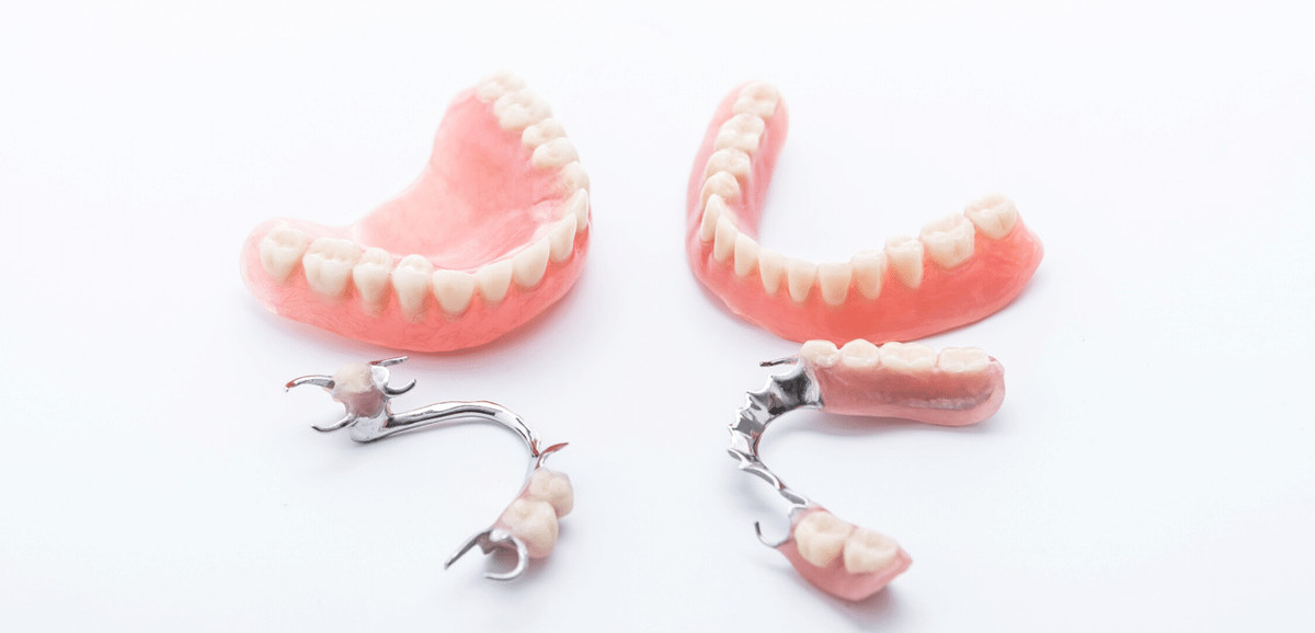 تغيير سن أو أكثر الخيار 3: طقم الأسنان الجزئي المتحرك